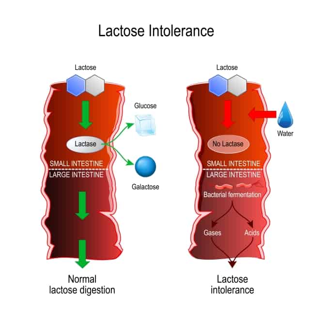 l'intolérance au lactose expliquée