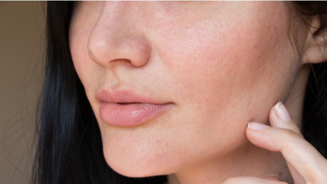peau sèche visage