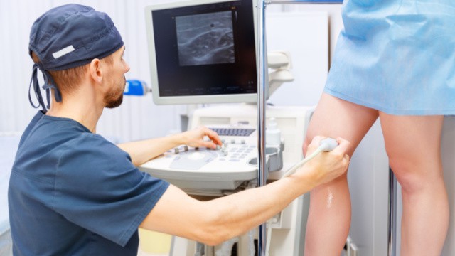 varices quand consulter un médecin