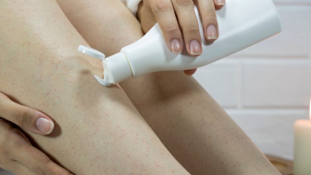 Crème de kératose pilaire