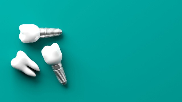 implant dentaire avec couronne
