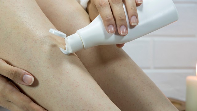 Keratosis pilaris crème