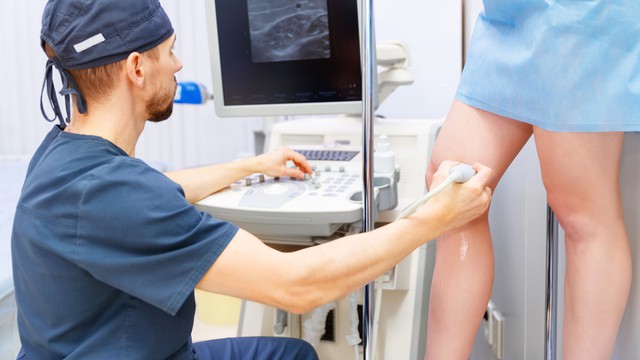 spataders wanneer naar dokter