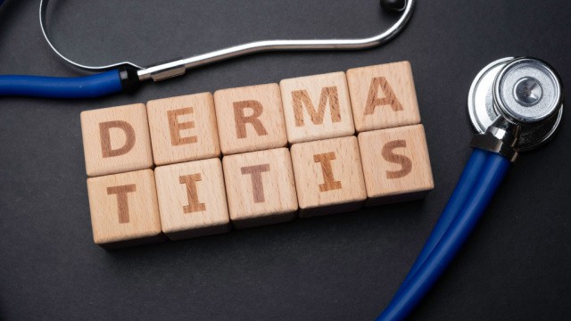 dermatitis perioralis oorzaak