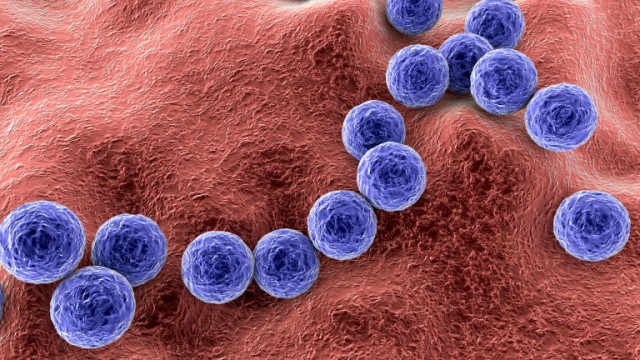 Streptocovccus pyogenes symptomen