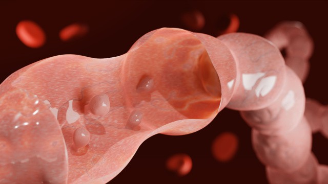 Colon poliepen