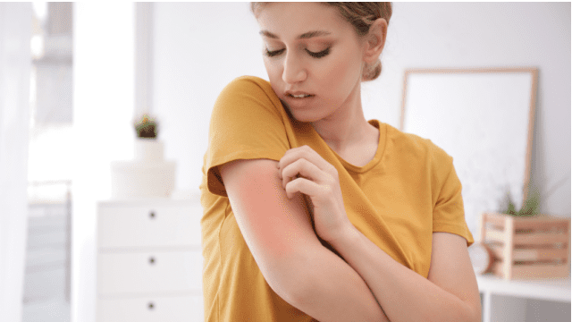 soorten allergie