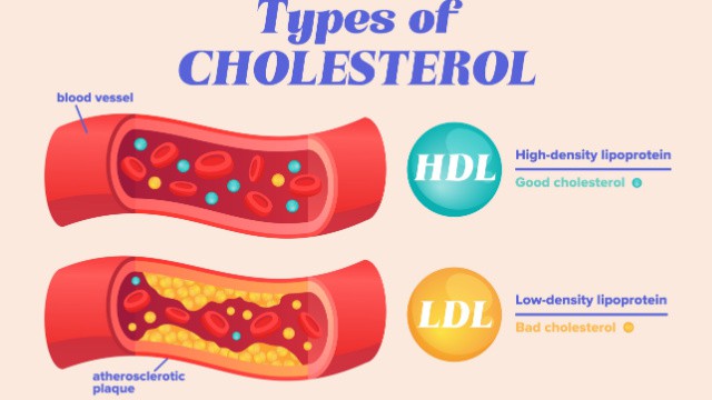 LDL- en HDL-cholesterol