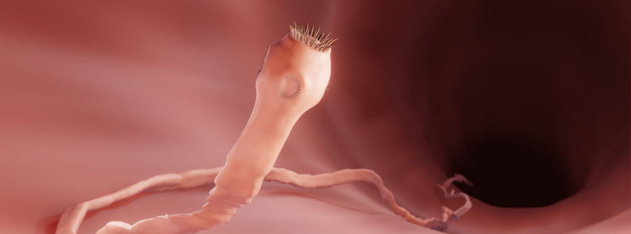 Hoe weet je of je een lintworm hebt?