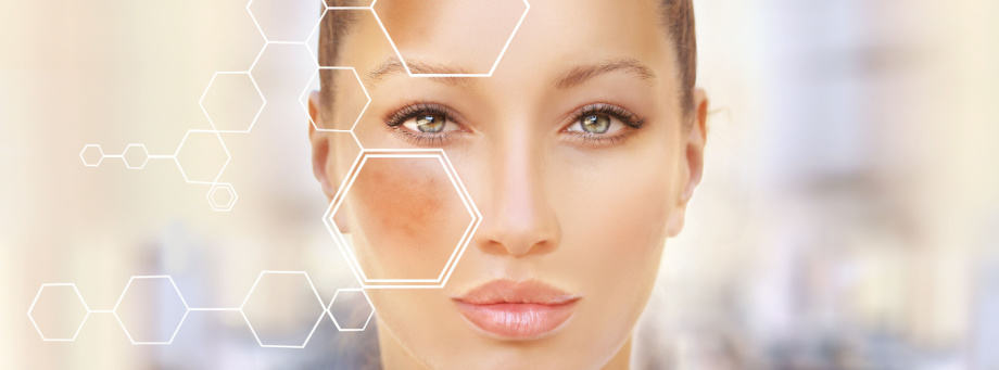 Qu'est-ce que l'hyperpigmentation et comment la traiter ?