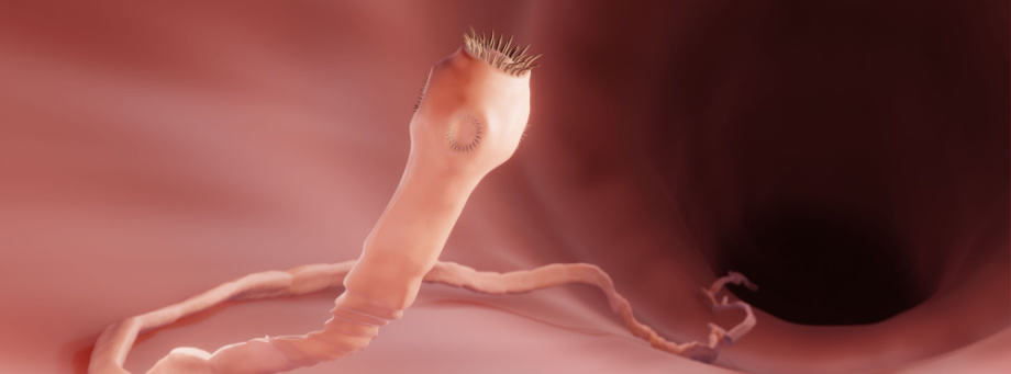 Comment savoir si vous avez un ténia ?